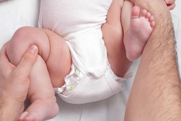 Дисплазия тазобедренных суставов