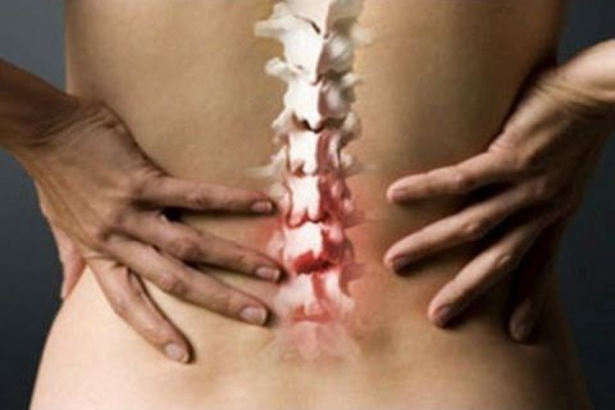 Почему болит позвоночник