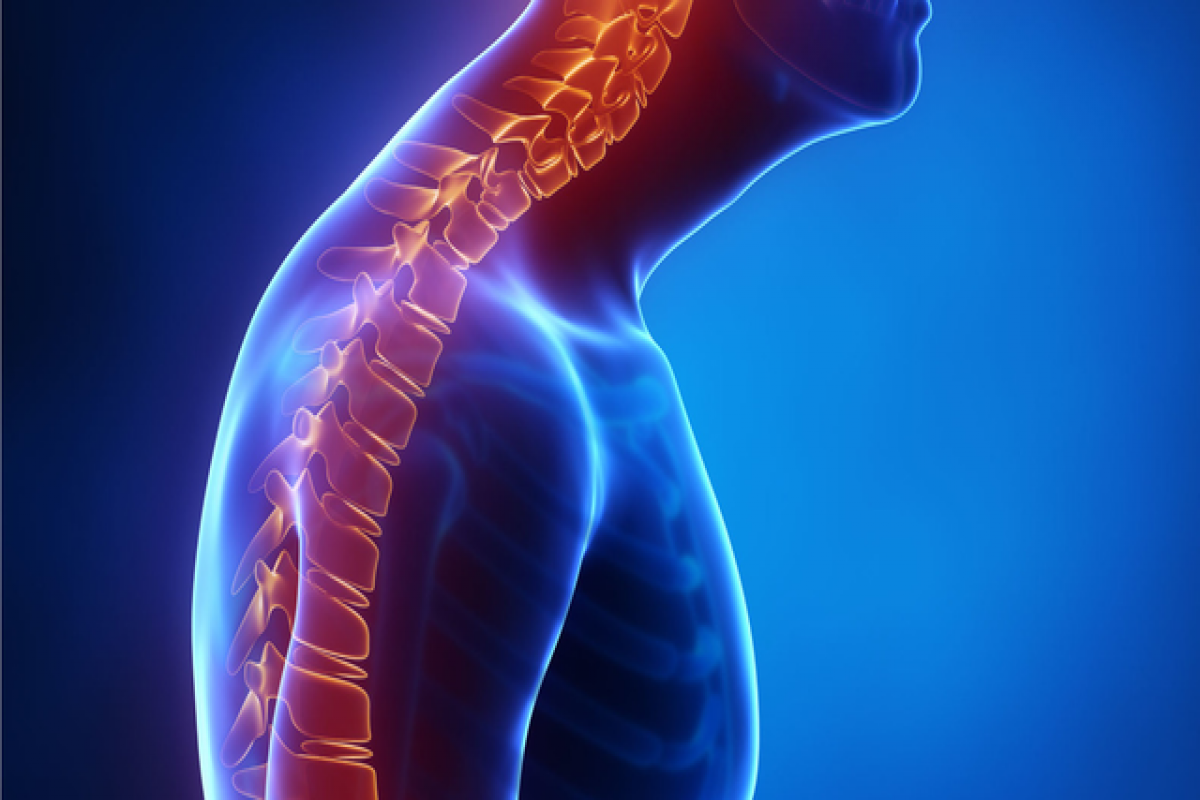 Болезнь позвоночника Шейермана-Мау