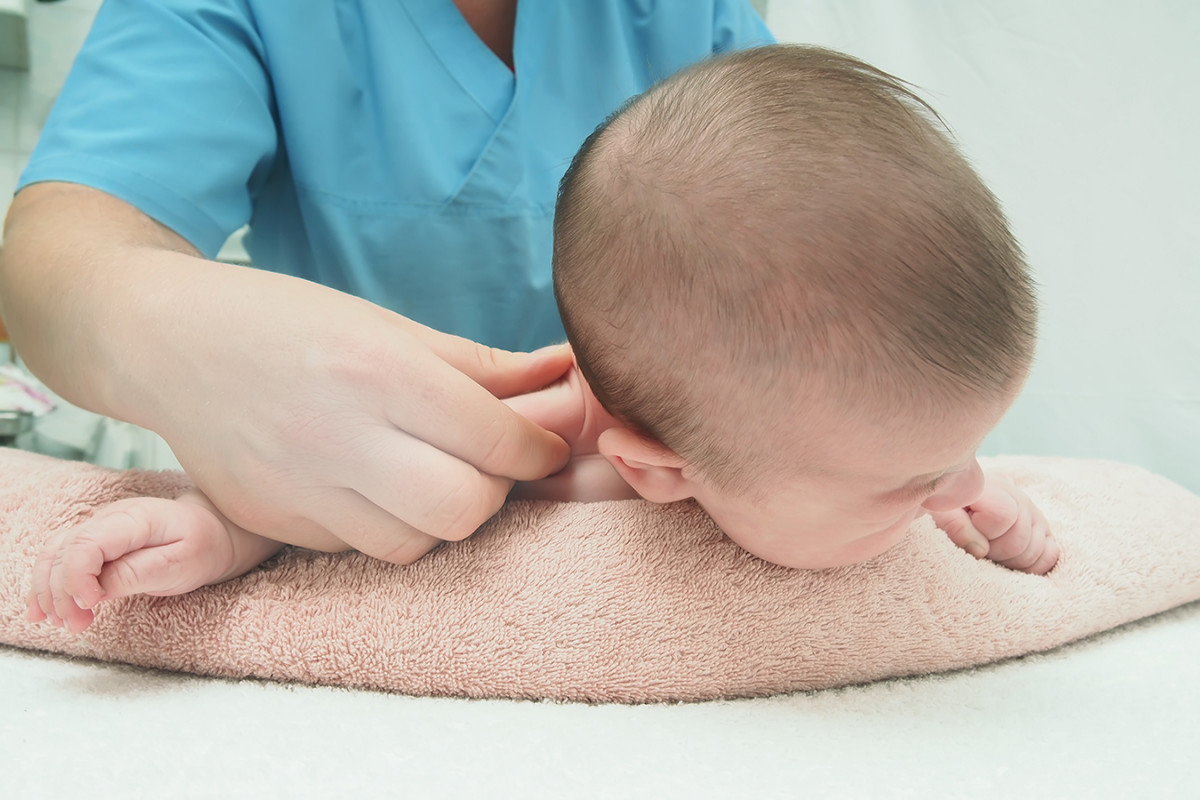 Мышечная дистония