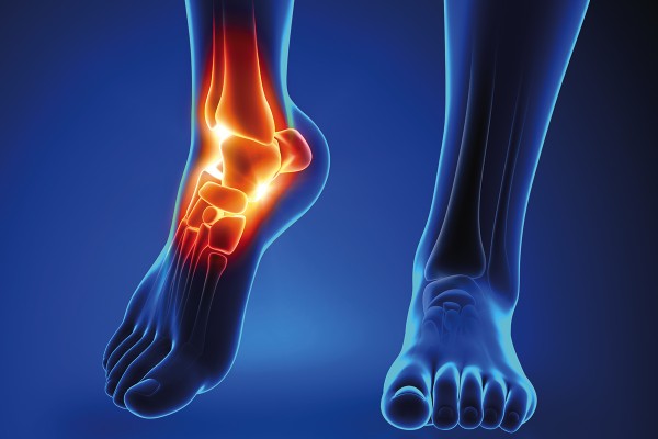 Нарушения формы стопы