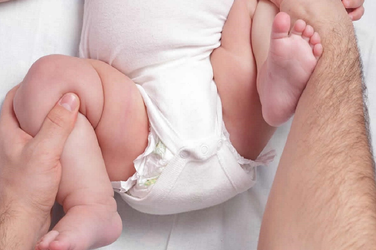 Дисплазия тазобедренных суставов