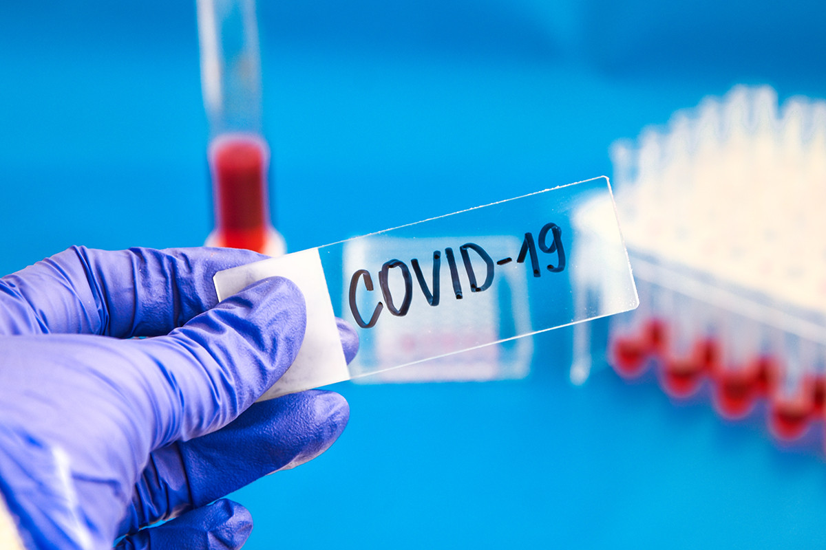 Анализ на антитела к COVID-19